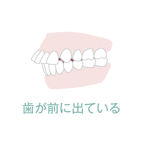 歯が前に出ている