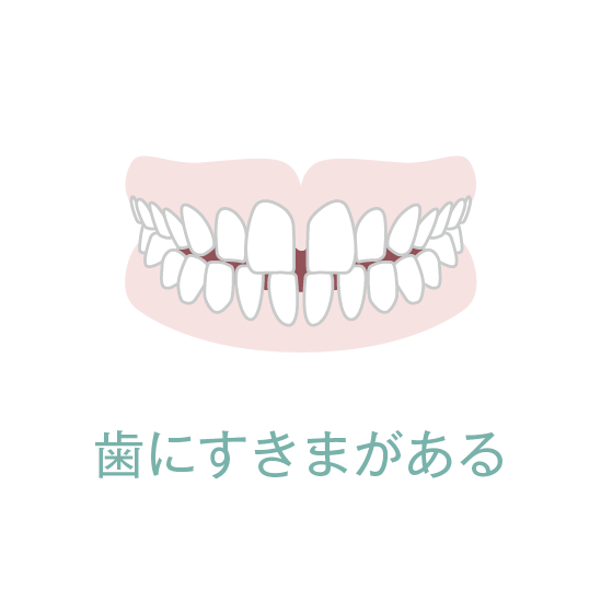 歯にすきまがある